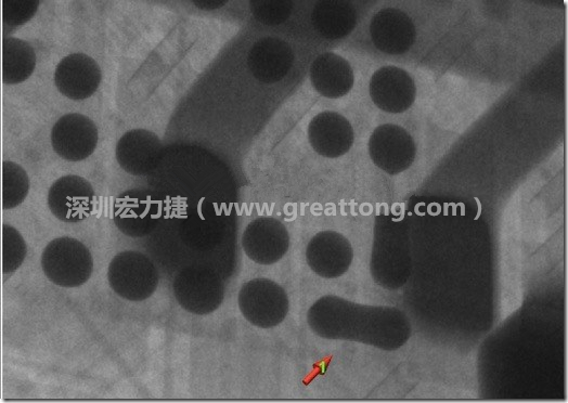 BGA因為焊墊變小，造成錫膏過多而最終形成焊接短路的結果。